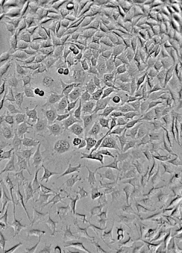 L929-fibroblasr-cell-line-mouse-recording-after-48-hours