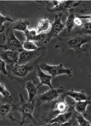 Phase-contrast-micrograph-at-10-magnification-of-HeLa-cells-24-h-after-seeding-to